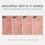 Thumbnail for Dermalogica Daily Microfoliant Face Scrub