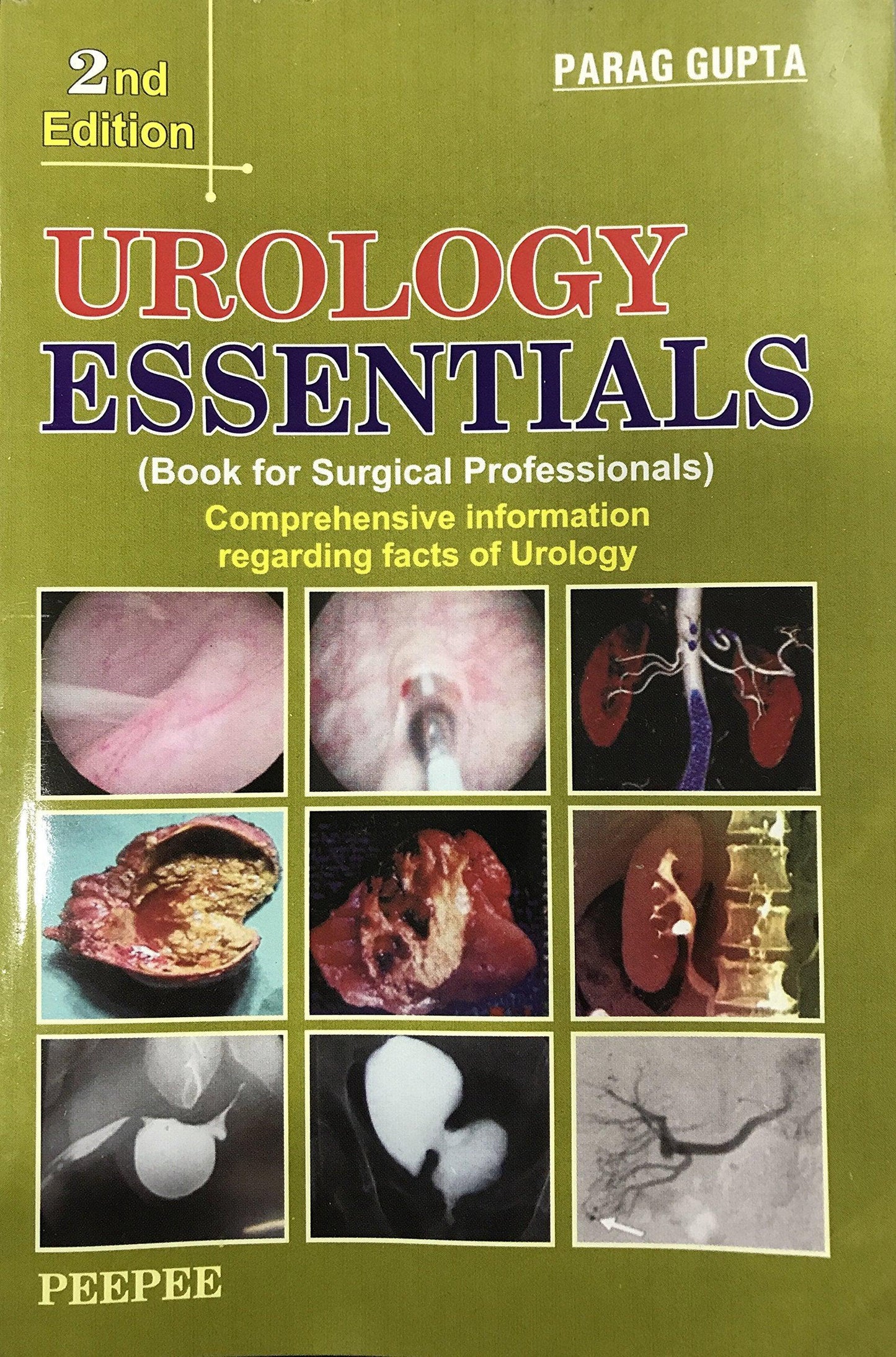 Urology Essentials, 2E-Parag gupta - Dista