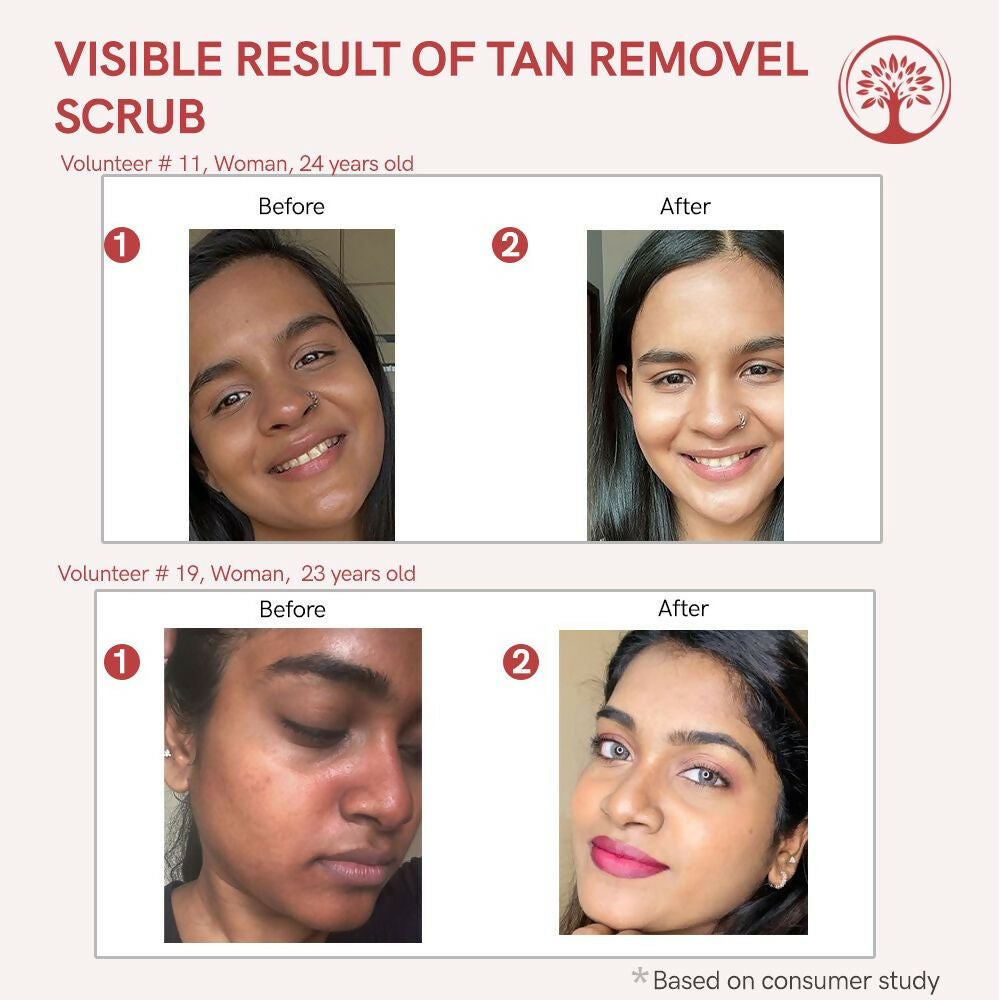 Ivory Natural Tan Scrub , Reduce Tan, Restores Radiant Skin Glow - Distacart