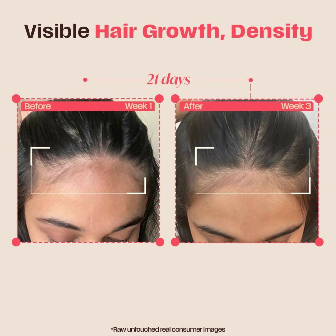 Days Ahead Leave-in Hair Growth Ampoule Serum (Roll on) - Dista