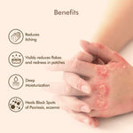 Thumbnail for VedicDerm Oleander's Oil for Psoriasis, Eczema, and Atopic Dermatitis - Distacart