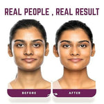Thumbnail for Our Cares Face Cream with Hyaluronic Acid & Vitamin E - Distacart