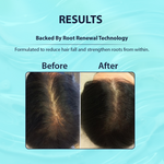 Thumbnail for Dermistry Follicusan Hairgenyl & Caffeine Anti Hair Fall Control Serum & Shampoo - Distacart