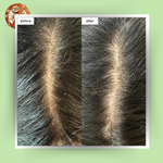 Thumbnail for Botanical Luxuriate Tea Tree Natural Anti Lice and Nits Shampoo - Dista
