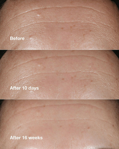 Clinique Smart Clinical Repair Wrinkle Correcting Serum - Distacart