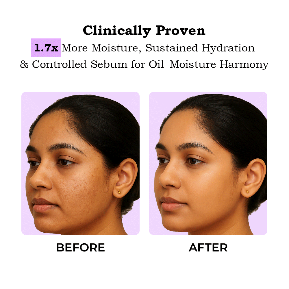TYC Ceramide Moisturizer - Dista