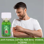 Thumbnail for Cipzer RingCure