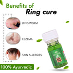 Thumbnail for Cipzer RingCure