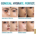 Thumbnail for Lakme 9 To 5 Hya Matte Liquid Concealer - Cocoa