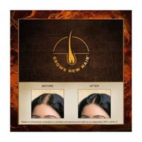 Thumbnail for Indulekha Bhringa Hair Oil - Distacart