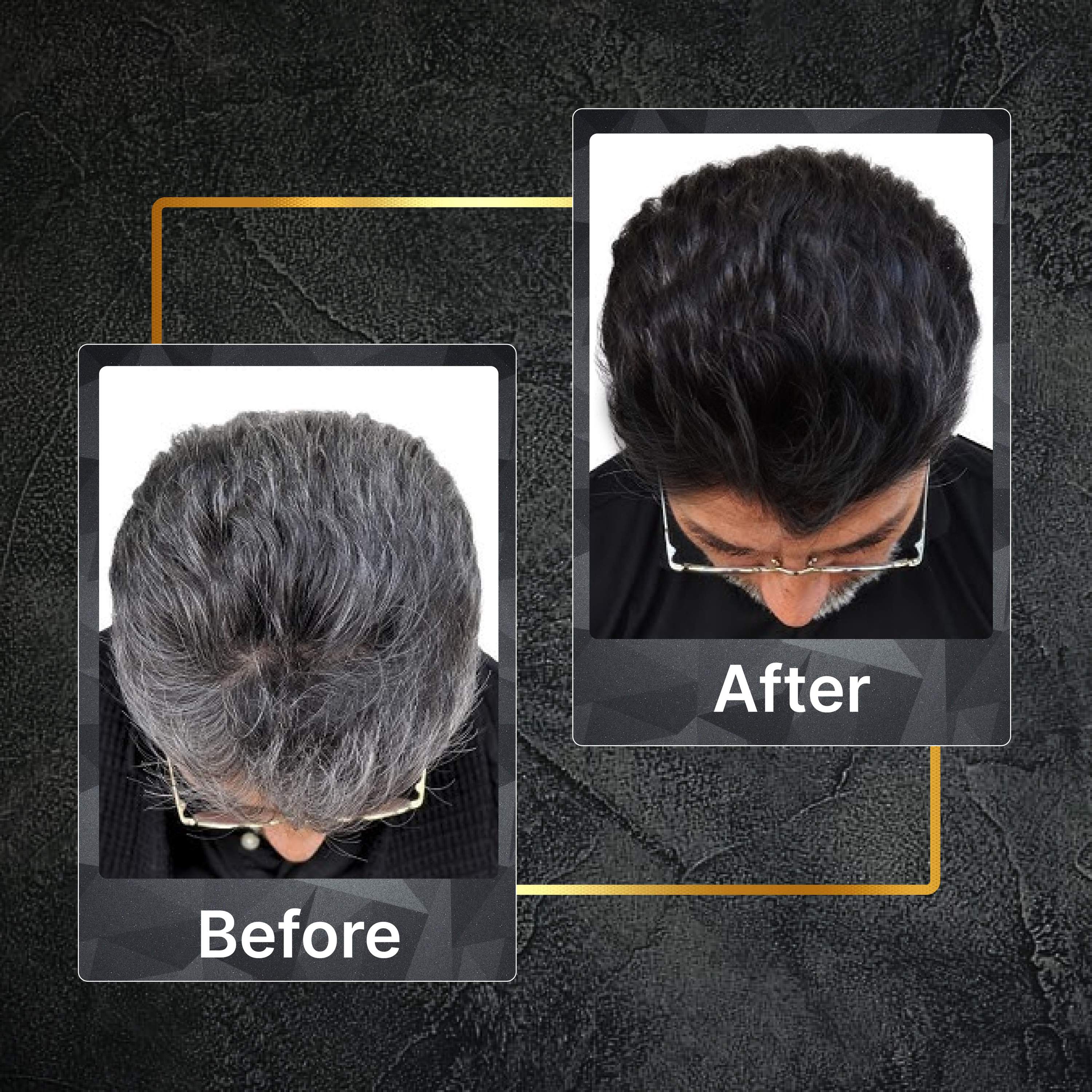 Tru Hair & Skin Black Colour Shampoo - Dista