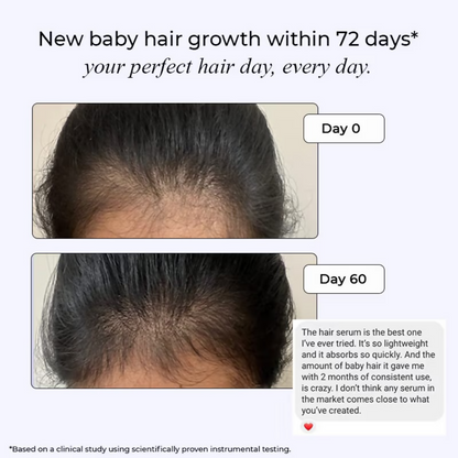 Dr. Su Revive Hair Growth Serum Hairfall Control - Dista