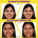 Thumbnail for NY Bae HD Spotless Concealer - Cool Tan 08