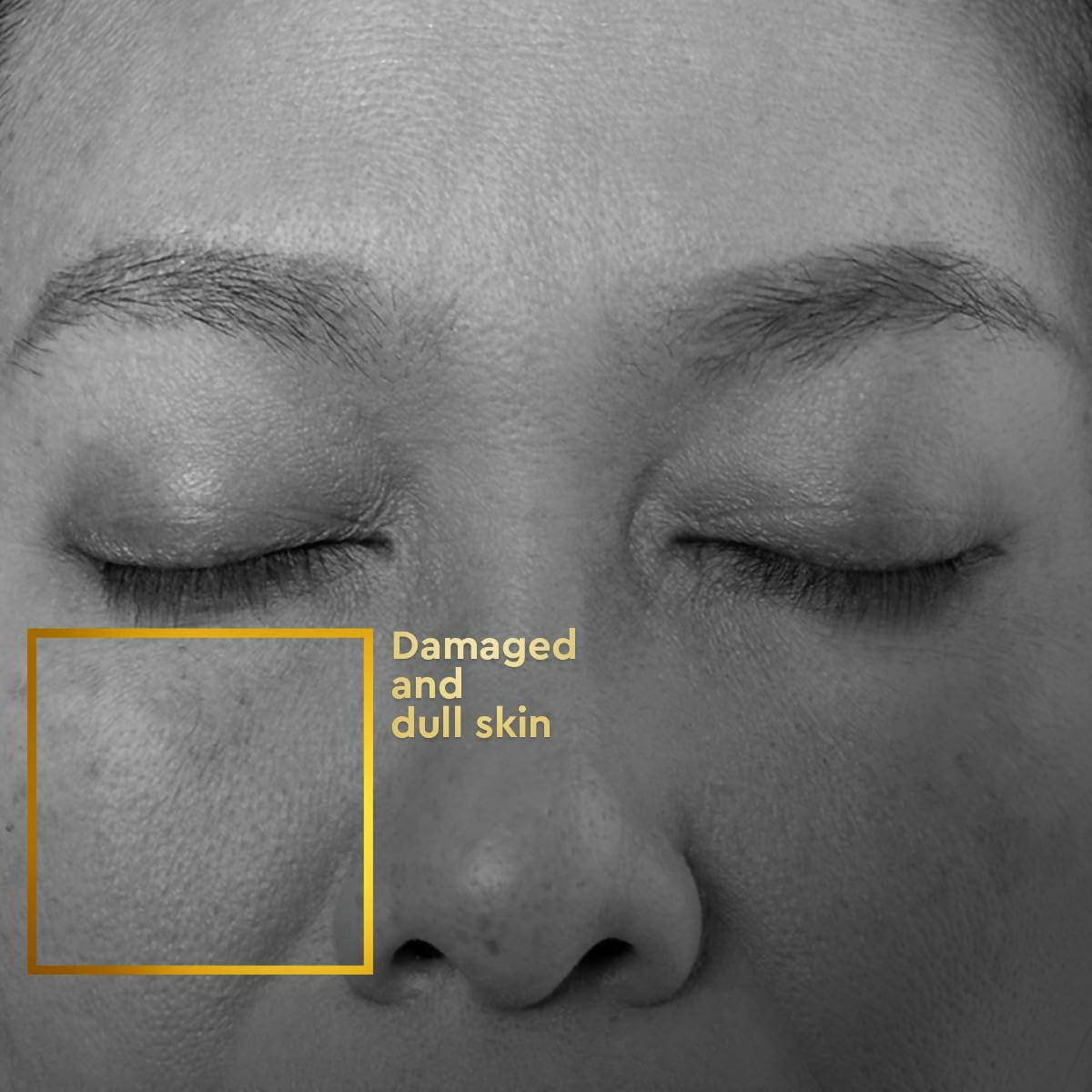 VLCC Clinic ProRescue Bio Cream - Distacart