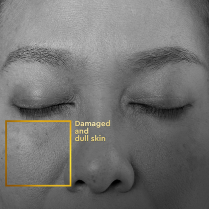 VLCC Clinic ProRescue Bio Cream - Distacart