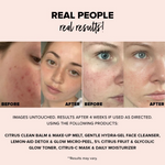 Thumbnail for Nudestix Nudeskin Lemon-Aid Detox & Glow Micro-Peel - Distacart