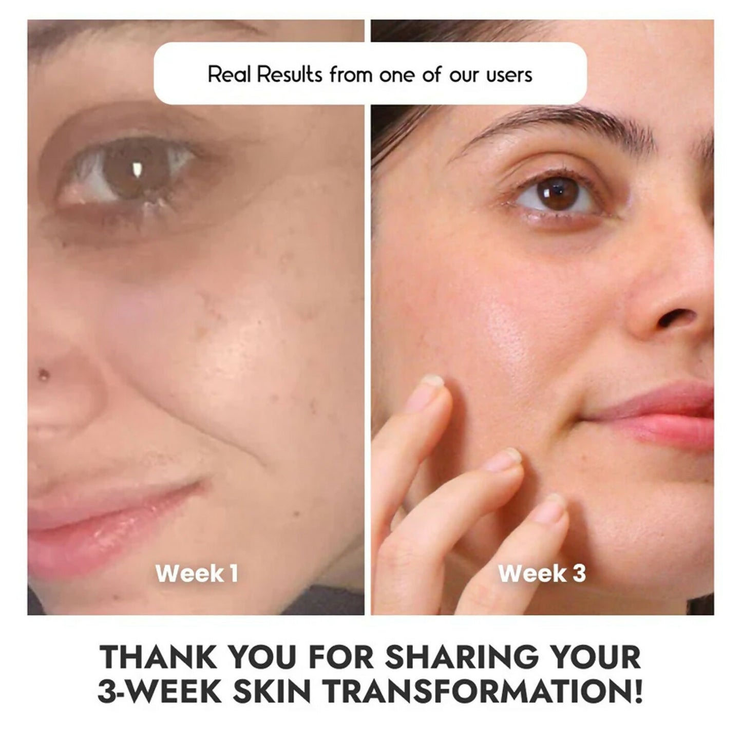 Cos-IQ Vitamin C-23% Face Serum - Distacart