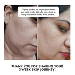 Thumbnail for Cos-IQ Niacinamide Vitamin B3-10% Face Serum for Ultra Sensitive Skin