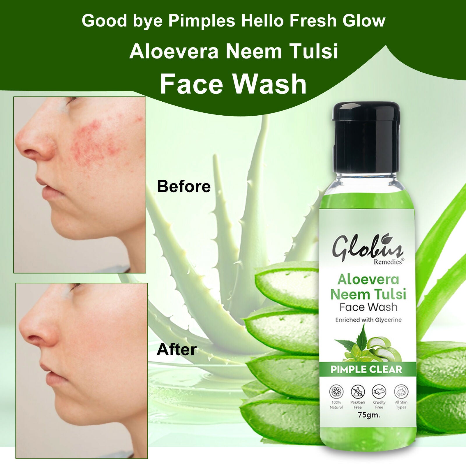 Globus Remedies Aloe vera Neem Tulsi Enriched With Glycerin & Oil Control Formula