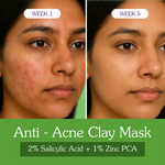 Thumbnail for Bake 2% Salicylic Acid + Zinc PCA Anti-Acne Clay Mask - Combo - Distacart