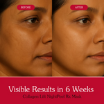 Thumbnail for Bake Collagen Peel Off Mask