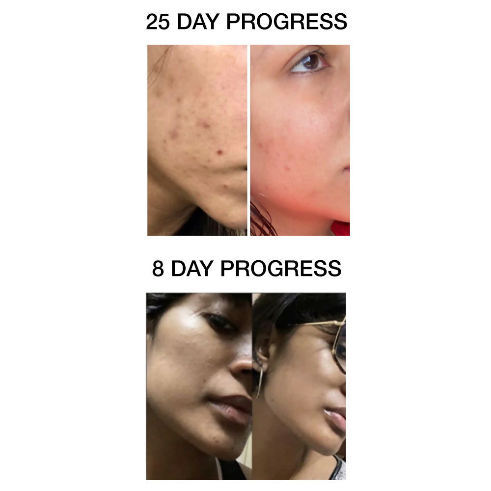 Skog Clarifying And Brightening Serum - Distacart