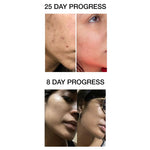 Thumbnail for Skog Clarifying And Brightening Serum