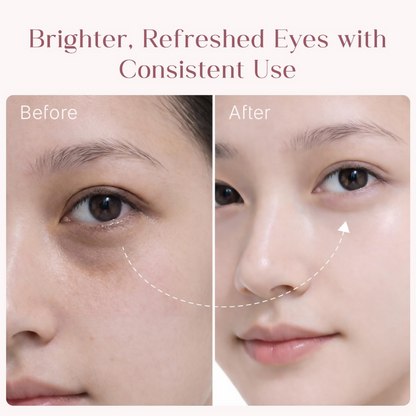 Seoulskin Under Eye Cream - Distacart
