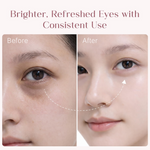 Thumbnail for Seoulskin Under Eye Cream - Distacart