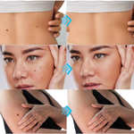 Thumbnail for Wipness Natural Wart Remover Cream For Men & Women - Distacart
