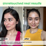 Thumbnail for PLIX The Plant Fix Salicylic Acid Face Cleanser & Spot Corrector Gel Combo - Distacart