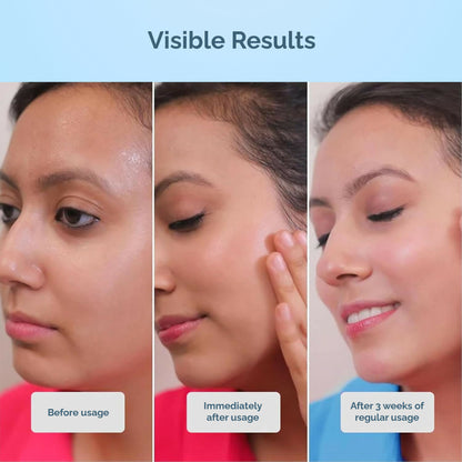 Cos-IQ AirGel NMF 15% for Oily Skin Moisturizer - Distacart