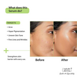Thumbnail for Nature Derma 2% Salicylic Acid Serum - Distacart