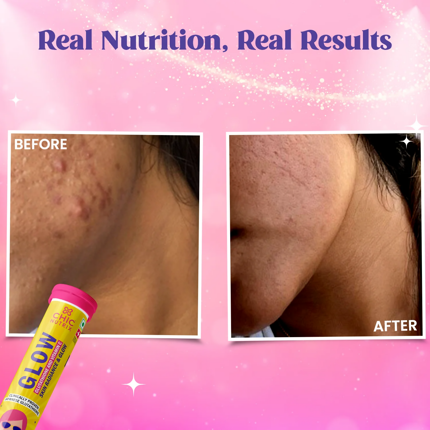 Chicnutrix Everyday Glow Combo - Glow & Outshine, Glutathione & Korean Brightening Serum - Distacart