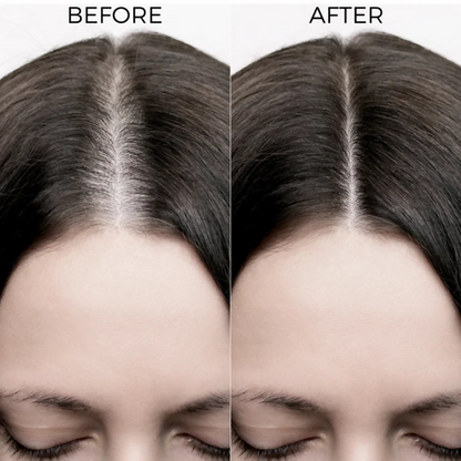 Brillare Rosemary Oil Shots For Visible Hair Growth - Dista