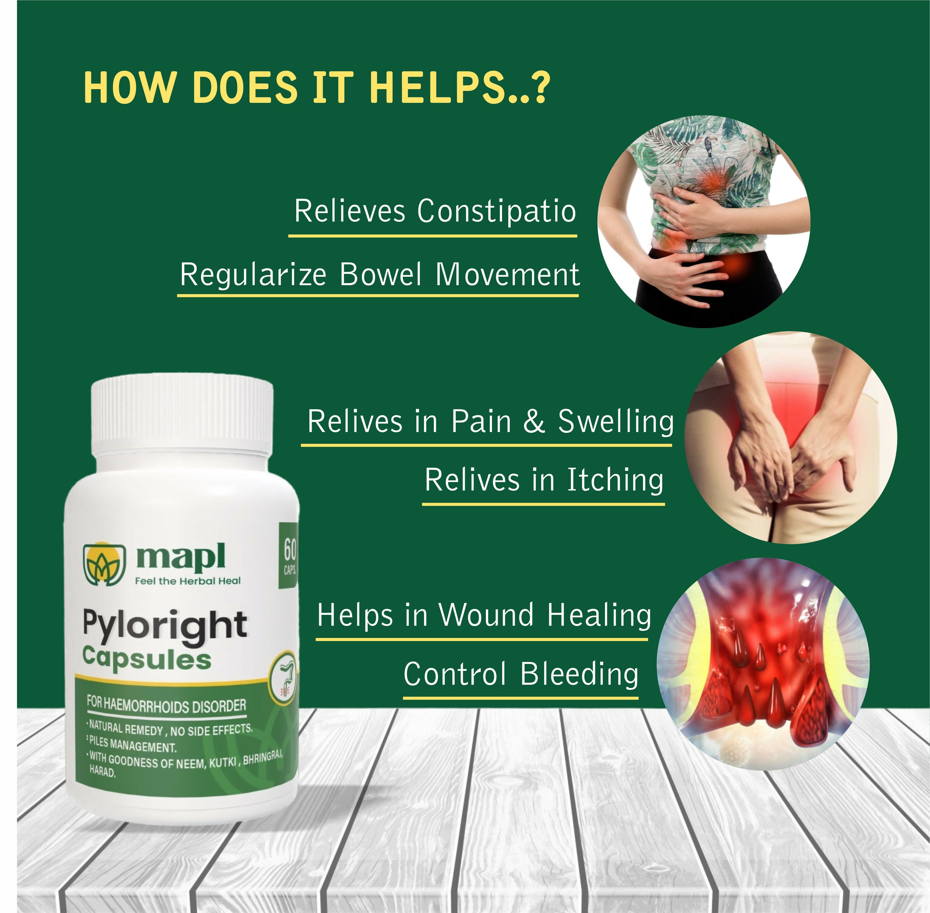 MAPL Pyloright Capsules