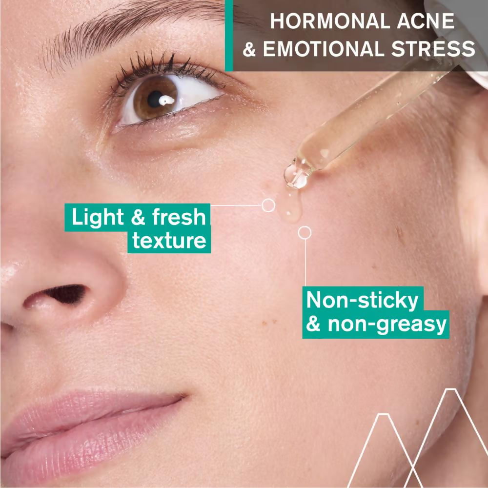 Uriage Hyseac Skin Anti-Blemish Serum 5.8% AHA for Hormonal Peak & Stress Acne - Distacart