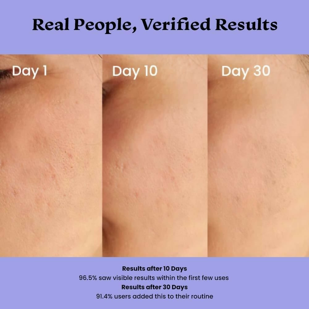 Foxtale 0.15% Beginner Friendly Retinol Night Serum, Anti-Aging, Reduces Fine Lines and Wrinkles, For Younger-looking Skin - Distacart