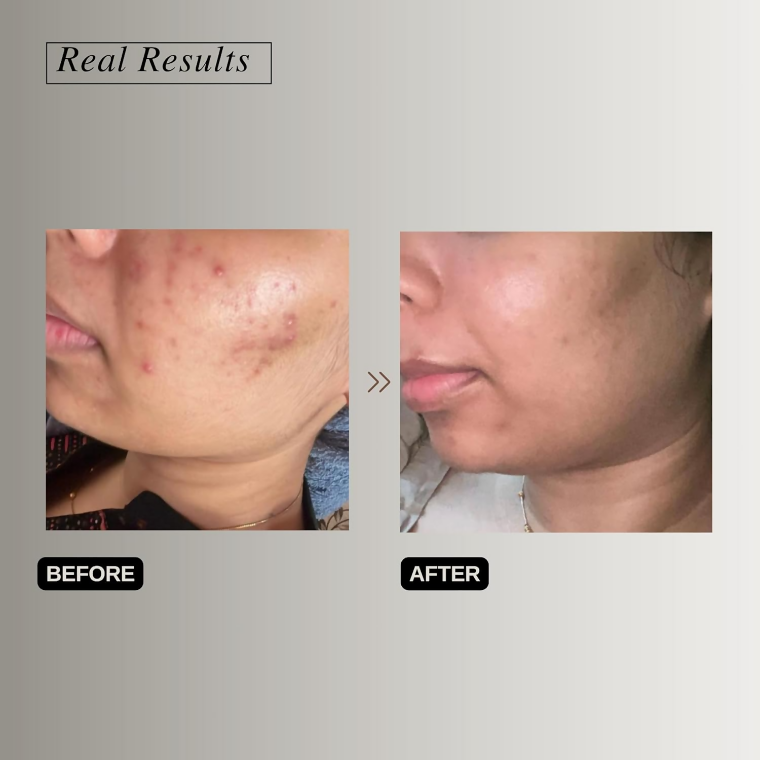 The Formularx Hydra Veil Malazia Hyaluronic Acid Gel Moisturizer - Distacart
