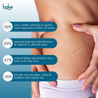 Bake StriErase™ Stretch Marks Removal Roll-On Serum - Distacart