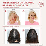 Thumbnail for Ivory Natural Organic Lemongrass Oil Pure & Premium Essential Oil For Face, Scalp & Skin - Distacart