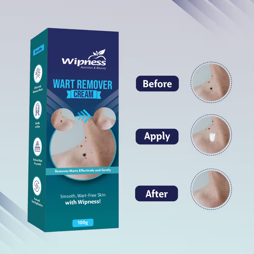 Wipness Natural Wart Remover Cream For Men & Women - Distacart