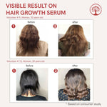 Thumbnail for Ivory Natural Serum For Growth Of Hair For New Hair Roots & Encouraging Growth Of Hair - Distacart