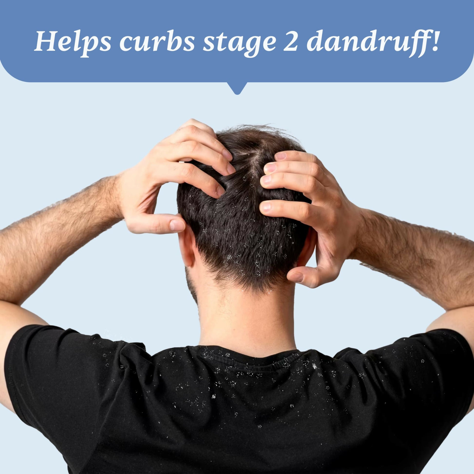 Man Matters Anti Dandruff Shampoo & Dandruff Removal Lotion Combo - Distacart