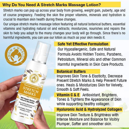 Mom & World Massage Lotion For Stretch Marks - Distacart