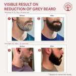 Thumbnail for Ivory Natural Greys Beard Serum Restore Natural Black Color Of Grey White Beard - Distacart
