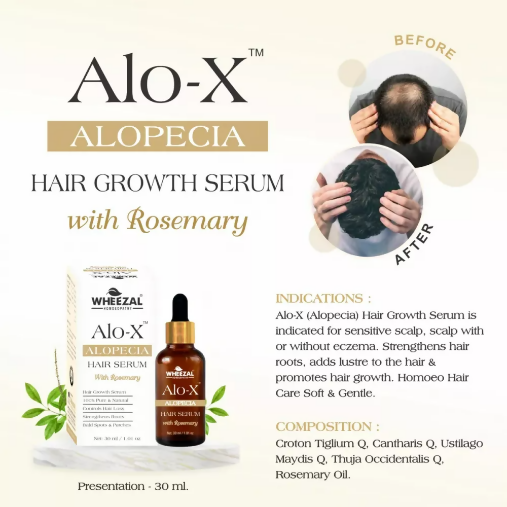 Wheezal Alo-X Alopecia Hair Serum - Distacart