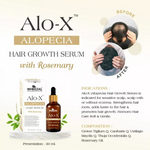 Thumbnail for Wheezal Alo-X Alopecia Hair Serum