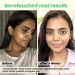Thumbnail for PLIX The Plant Fix 2% Alpha Arbutin Pineapple Moisturizer With SymWhite PLUS For Hyperpigmentation & Dark Spots - Distacart