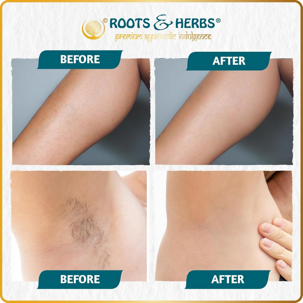Roots and Herbs Neem and Fennel Depilatory Ubtan for Hair Removal - Distacart